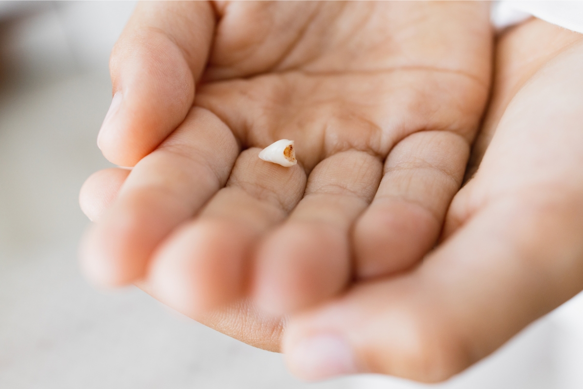 What to Do If Your Child Swallows a Tooth or Dental Piece