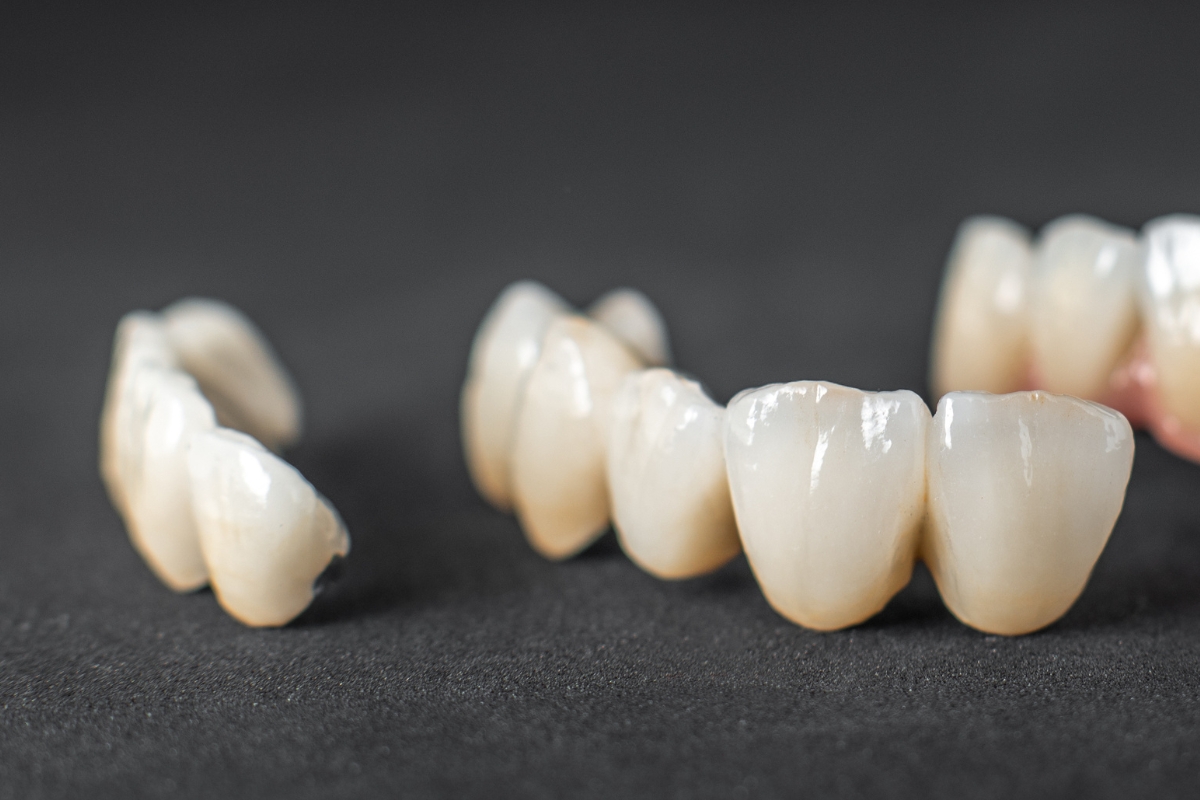 What Causes a Kid’s Tooth Crown to Turn Black